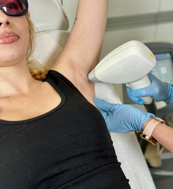 DEPILACJA LASEROWA KRAKÓW. PERFECT ESTETIC SALON KOSMETYCZNY