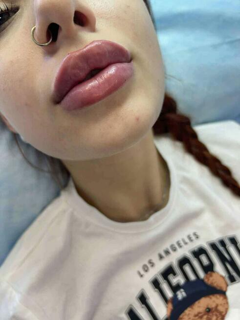 New Derm Magdalena Chilewska