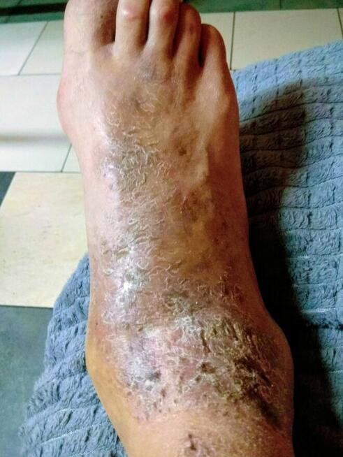 BARDZO PROSZĘ O PILNĄ POMOC