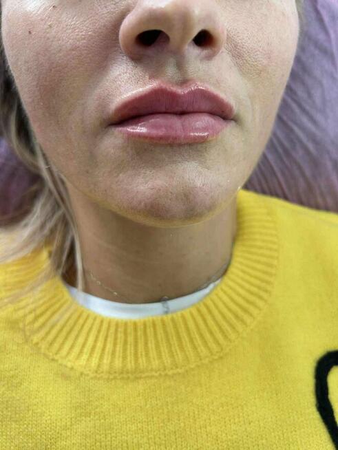 New Derm Magdalena Chilewska