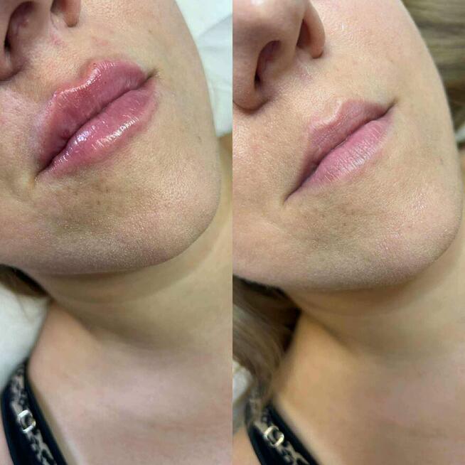 New Derm Magdalena Chilewska