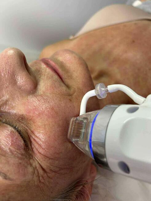 New Derm Magdalena Chilewska