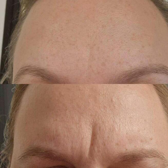 New Derm Magdalena Chilewska