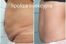 ZMARSZCZKI, PODBRÓDEK, USTA, NACZYNKA, BRZUCH - 8