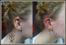 MODYFIKACJE CIAŁA - PIERCING, SKARYFIKACJE, IMPLANTY - 9
