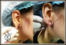 PIERCING SKARYFIKACJE IMPLANTY i inne - Warszawa - 14