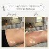 PROFESJONALNE KURSY SZKOLENIA KOBIDO KORUGI KOBIDO BODY - 4