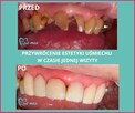 Stomatologia Estetyczna - Dentamax Kraków - 3