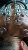 Masaże, hirudoterapia tlenoterapia - 5
