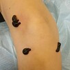 Masaże, hirudoterapia tlenoterapia - 8