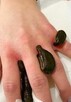 Masaże, hirudoterapia tlenoterapia - 2