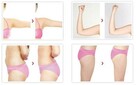 Fit&Roll! Kriolipoliza, Lipolaser, Ultradźwięki - 3w1 - 7
