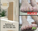 Usługi podologiczne - 3