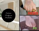 Usługi podologiczne - 4