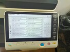 Naprawa ksero kopiarki drukarki Konica Minolta Ineo i innych - 12