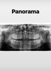 PANTOMOGRAM / DYNÓW / RTG - 2