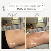 PROFESJONALNE KURSY SZKOLENIA KOBIDO KORUGI KOBIDO BODY - 8