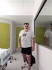 Michałowi grozi amputacja! Pomóż! Pilnie potrzebna pomoc - 6
