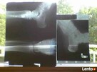 SKUP KLISZ, BŁON,ZDIĘC RENTGENOWSKICH.RTG.tel.506-348-194 - 4