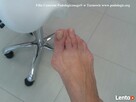 Zabiegi podologiczne - 4