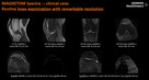 Rezonans Magnetyczny 3T-MAGNETOM Spectra 3T marki Siemens - 13