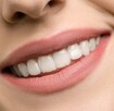 Profesjonalna higienizacja zębów higienizacja jamy ustnej - 7