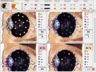 Diagnostyka NLS: Metatron, Diacom, 3D-NLS, inne - sprzedaż i - 8