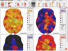 Diagnostyka NLS: Metatron, Diacom, 3D-NLS, inne - sprzedaż i - 4