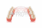 Naprawa protez zębowych - Protezy Elastyczne 511 511 441 - 3