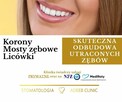 Bezpłatne usuwanie zębów i protezy w Dąbrowie Górniczej - 2