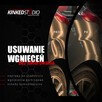 Usuwanie wgnieceń bez lakierowania (PDR) - Kinked Studio - 3
