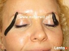 Leczenie Pijawkami Lekarskimi Bytom - 6
