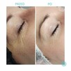PROFESJONALNE KONSULTACJE W PERFECT LOOK CLINIC WE WRZESNI - 6