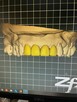 Oferta współpracy Technik Dentystyczny CAD/CAM - 2