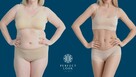 PROFESJONALNE KONSULTACJE W PERFECT LOOK CLINIC WE WRZESNI - 9