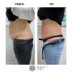 PROFESJONALNE KONSULTACJE W PERFECT LOOK CLINIC - 12