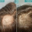 PROFESJONALNE KONSULTACJE W PERFECT LOOK CLINIC - 16