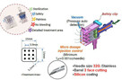 Venustar Injector - mezoterapia podciśnieniowa wieloigłowa - 5