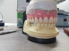 Ekspresowa naprawa protez zębowych Denti-lab 536 800 840 - 6