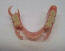 Ekspresowa naprawa protez zębowych Denti-lab 536 800 840 - 5