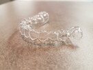 Ekspresowa naprawa protez zębowych Denti-lab 536 800 840 - 8
