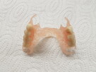 Ekspresowa naprawa protez zębowych Denti-lab 536 800 840 - 4