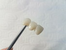 Ekspresowa naprawa protez zębowych Denti-lab 536 800 840 - 7