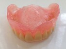 Ekspresowa naprawa protez zębowych Denti-lab 536 800 840 - 3