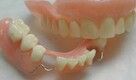 Ekspresowa naprawa protez zębowych Denti-lab 536 800 840 - 1
