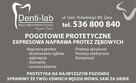 Ekspresowa naprawa protez zębowych Denti-lab 536 800 840 - 2