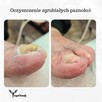 Pielęgnacja stóp SENIORA z dojazdem. - 2