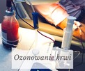 Chelatacja Warszawa Oczyszczanie organizmu - 6