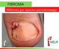 Podologia HELP PODOLOG Tarnowo Poznań - 14