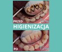 Higienizacja Zębów - Dentamax Kraków - 4